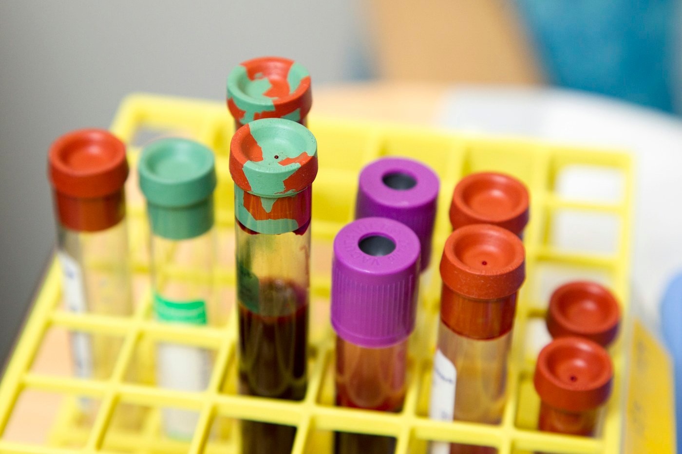 Blood sample tubes prepared for a Blood Chem 6 panel